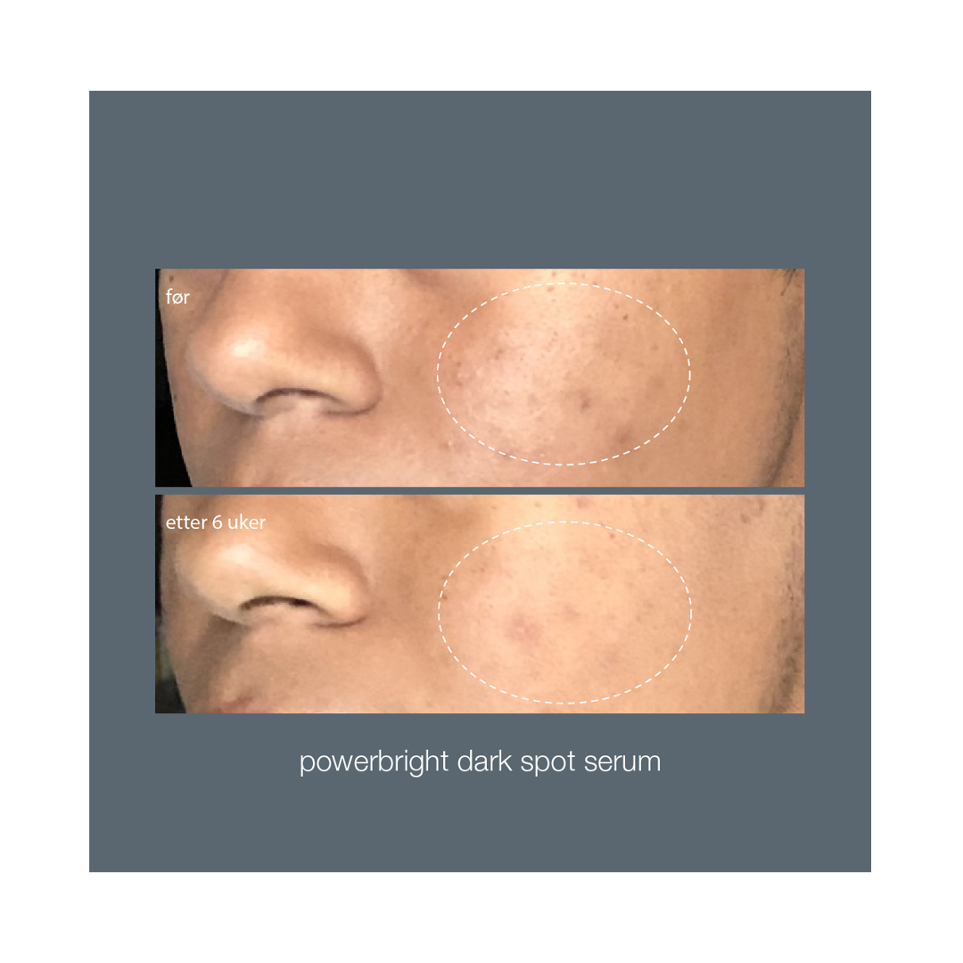 Dermalogica Powerbright Dark Spot Serum