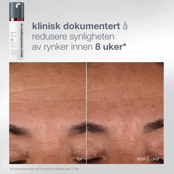 Dermalogica Expert Protect + Renew Kit