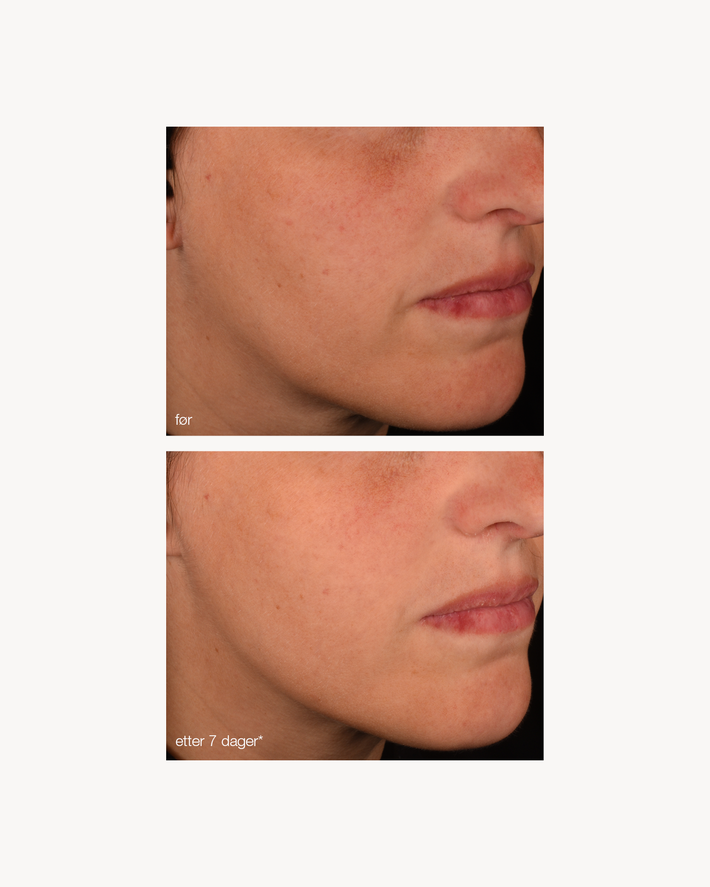 Dermalogica Pro-Collagen Banking Serum