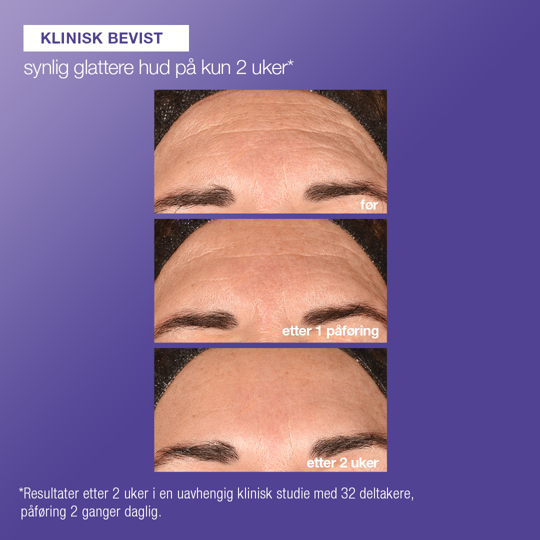 Dermalogica Phyto Nature e2 peeling med eksosomer